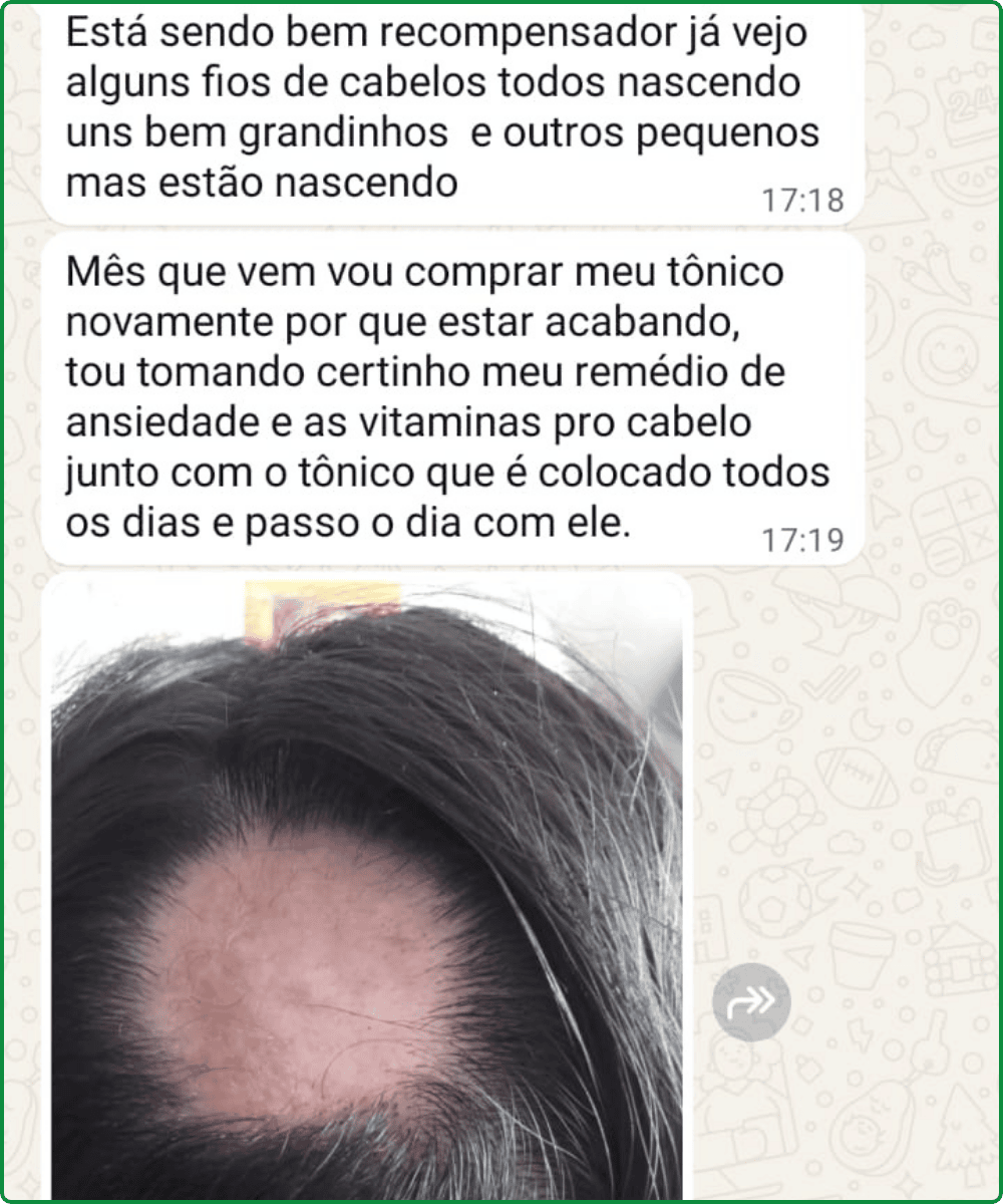 Depoimento 3
